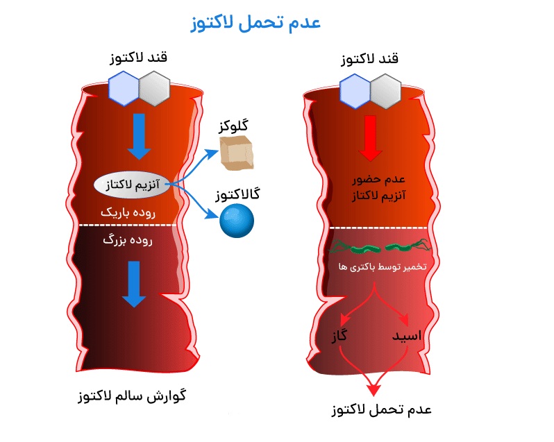 عدم تحمل لاکتوز یعنی چه